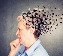 Pacientes com Alzheimer têm até três vezes mais chances de desenvolver quadros graves de covid-19, apontam pesquisadores